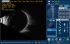 Accutome by Keeler B-scan Plus