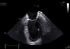 GE Healthcare Vivid E90