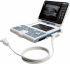 Esaote MyLab Gamma