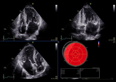 GE Healthcare Vivid E90
