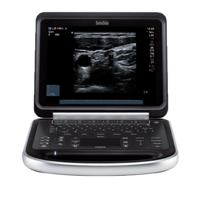 Fujifilm Sonosite Edge